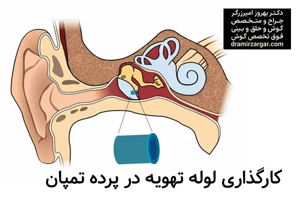 میرنگوتومی https://dramirzargar.com/